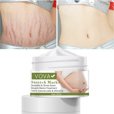 跨境vova Remove Stretch Mark Cream  30ml  速卖通 亚马逊 Wish