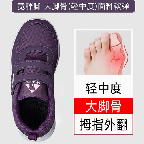 张凯丽老人脚肿宽松鞋女头大脚骨