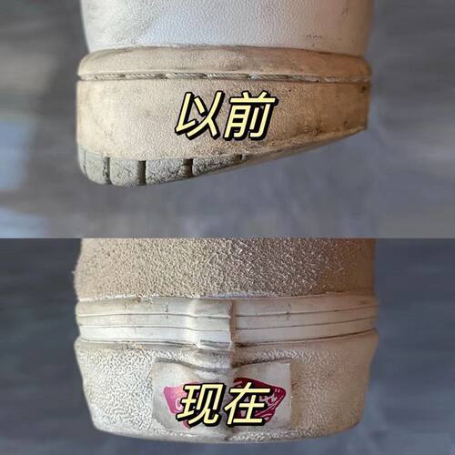 矫正内外八字]成人小腿外翻矫正鞋垫直腿神器鞋跟磨损纠正xo