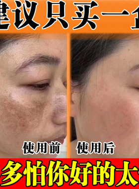 老年斑黄褐斑去除就掉分解黑色素强力手部脸部一擦官方正品精华液