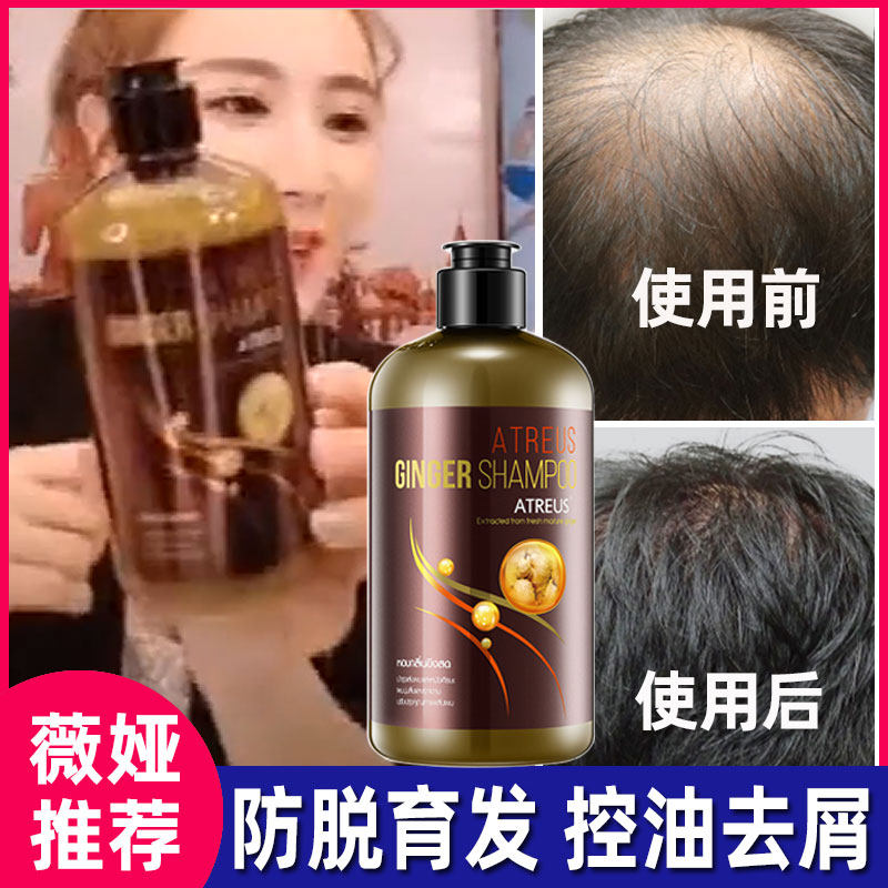 泰国atreus生姜洗发水 防脱生发排行榜第一名控油蓬松去屑止痒