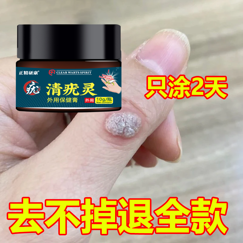 强效款快速肉粒疙瘩手脚皮肤刺猴瘊子正品身上点消毒护理清外用膏