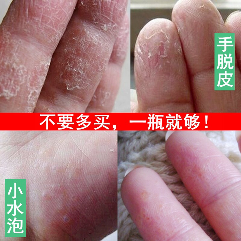 已经帮助10万＋人解决皮肤问题了