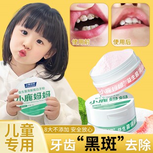 儿童牙齿黑斑去除专用牙粉去黑渍牙黄美白去黄清洁神器牙菌斑祛除