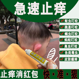冰蚕止痒膏蠓虫跳蚤咬祛叮包儿童止痒药膏蚊子叮咬过敏起红包