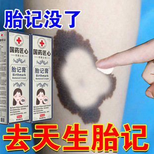 【小杨哥推荐】去黑色素去斑点青红胎记咖啡雀斑太田痣去胎记膏