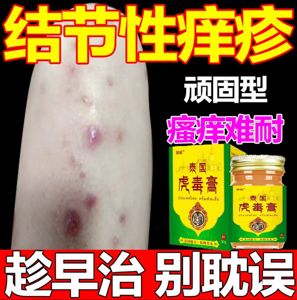 结节性痒疹特治顽固硬疙瘩胳膊小皮肤消毒护理（消）
