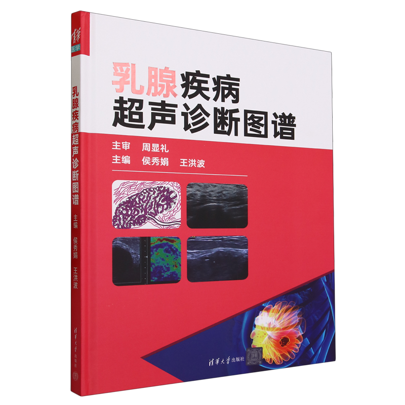 新华正版 乳腺疾病超声诊断图谱精 编者:侯秀娟//王洪波 清华大学