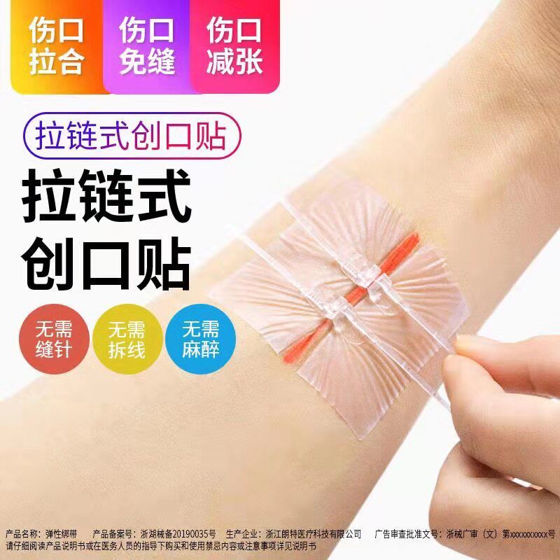 免缝创可贴拉链式2片/盒弹性绷带医用减张器创口贴免缝针胶带皮