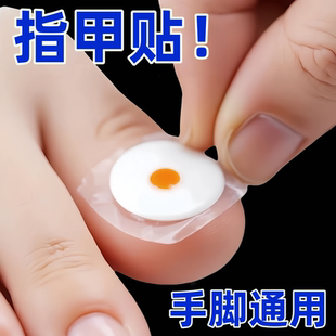 专用贴植物萃取贴片 脚趾指甲贴改善修护黑甲坏甲正品 香港专研