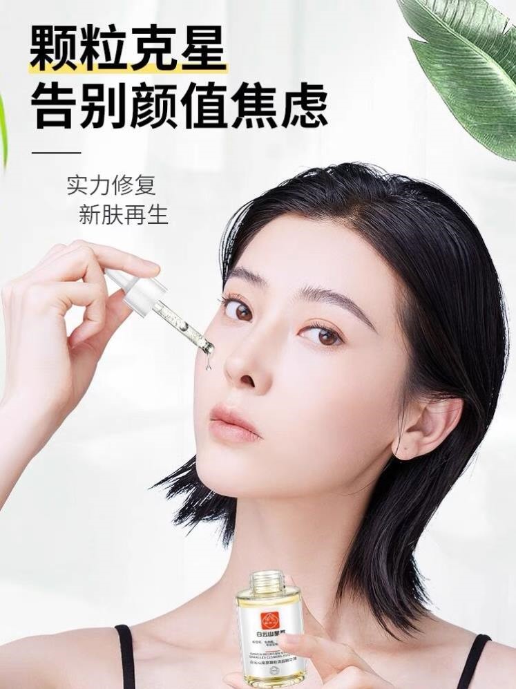 去脂肪粒去除神器眼部祛除油脂粒汗管粒脸部眼霜精华液专用去除膏