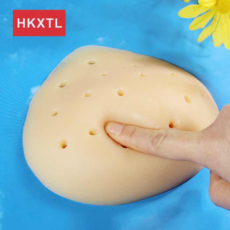 医院推荐术后义乳品质保证
