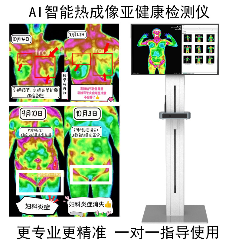 AI热成像亚健康检测仪全身项目红外线热CT体检仪器健康一体机中医