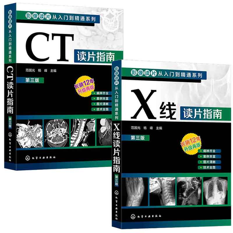影像读片从入门到通系列 CT读片指南+X线读片指南 第三版3版 范国光 杨峰  2本 化学工业出版社