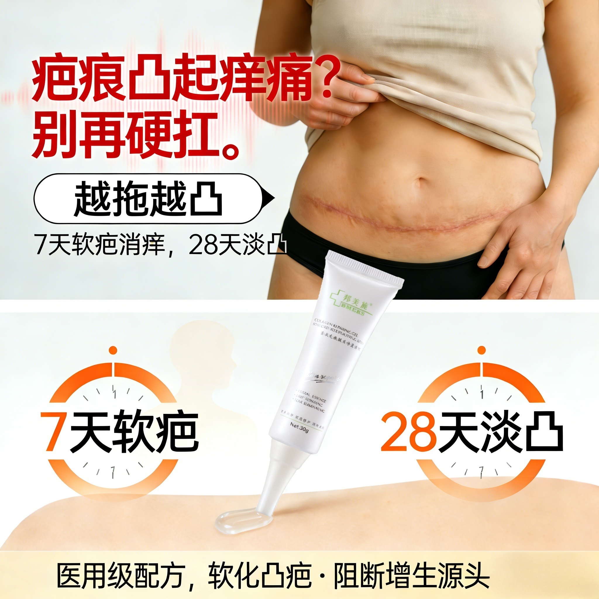 疤痕疙瘩凸起增生修复凝胶术后护理烧烫伤软化疤痕淡化剖腹产凸疤
