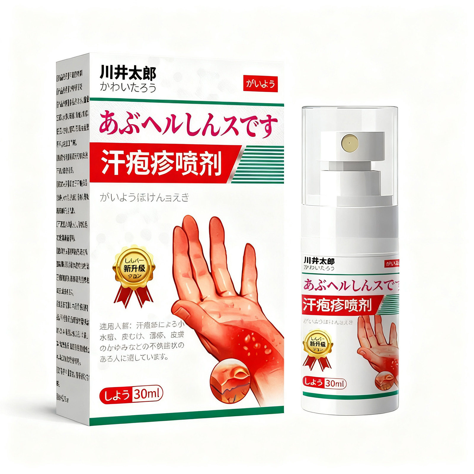 日本汗疱疹止痒专去角化型皮肤手癣药膏根手上起小水泡用湿疹软膏