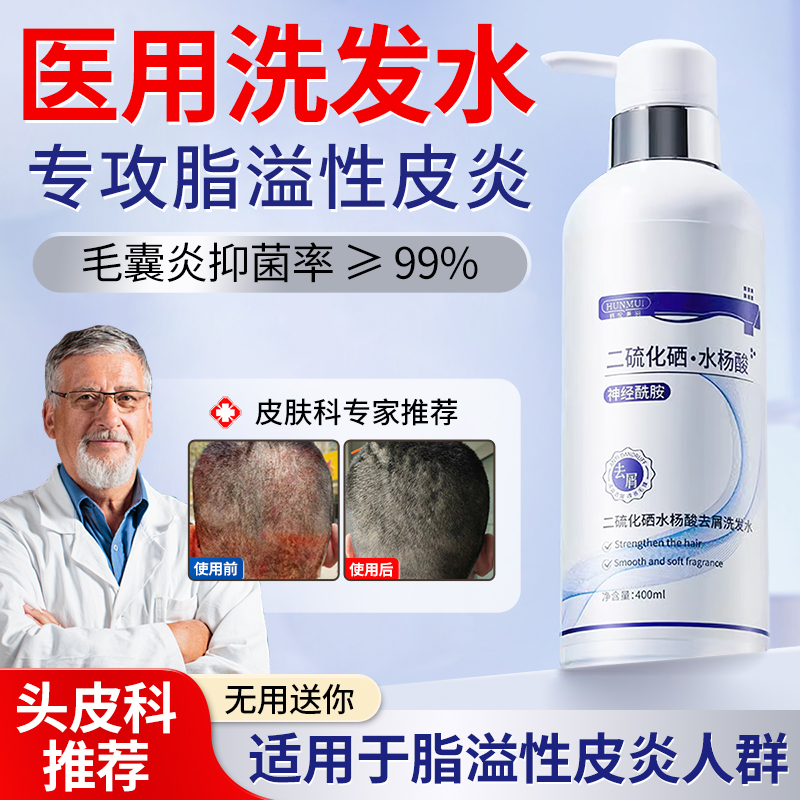 【高级配方】脂溢性皮炎洗发水