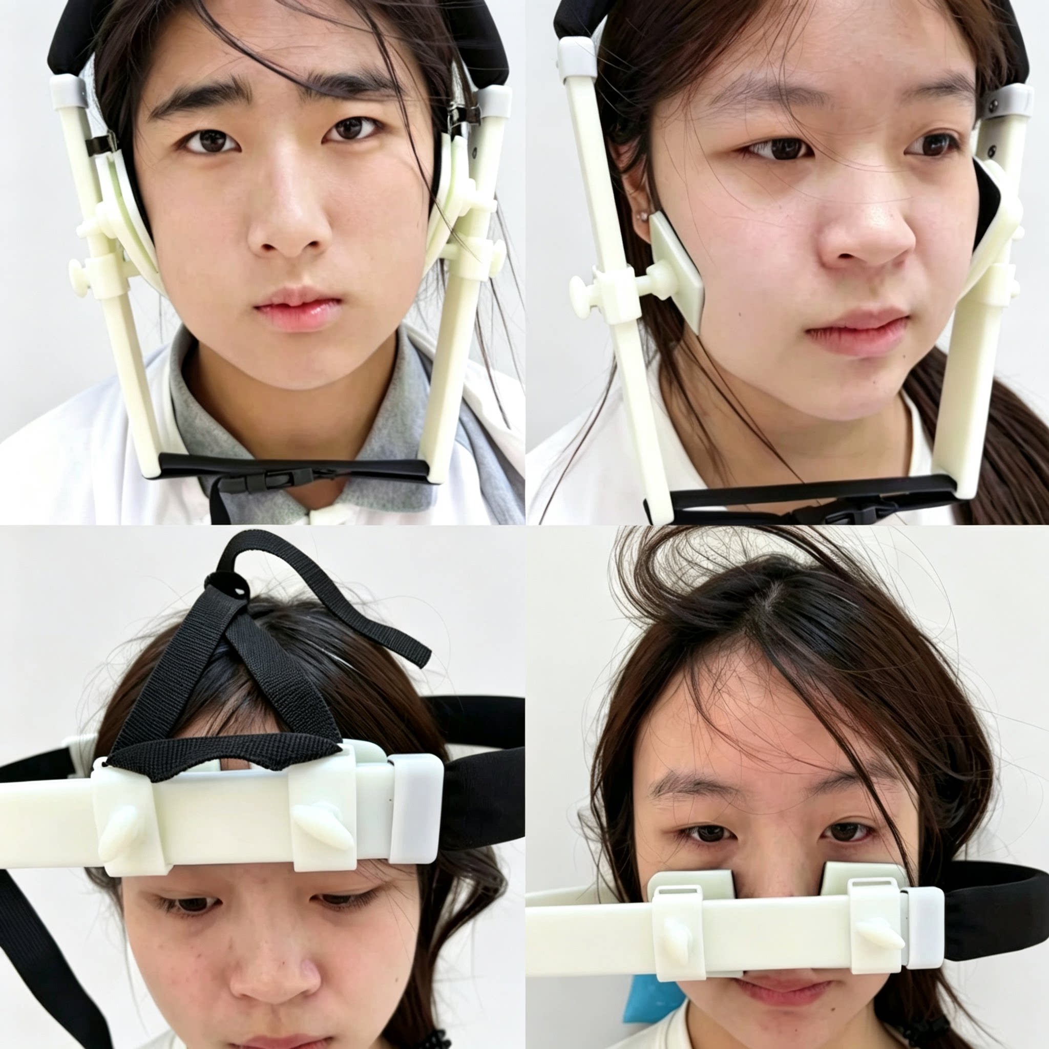 瘦脸神器矫正太阳穴凹陷 大小脸全脸内推器V脸神器