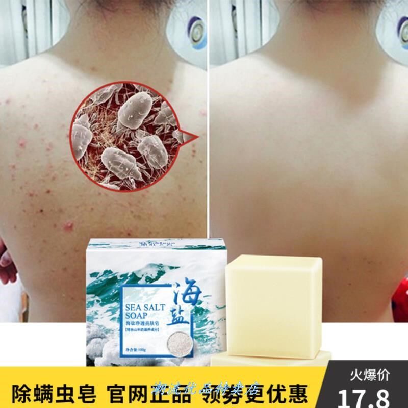 新款香皂螨虫除处去排祛蝻婷螨停瞒蛮满虫皂控油除螨身体去油洗脸