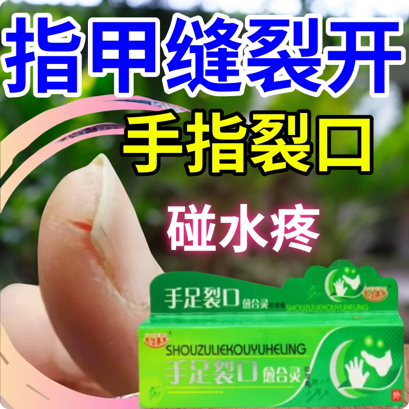手裂口脱皮药膏手指严重裂口指甲缝裂口脚后干裂防皲裂开裂修复霜