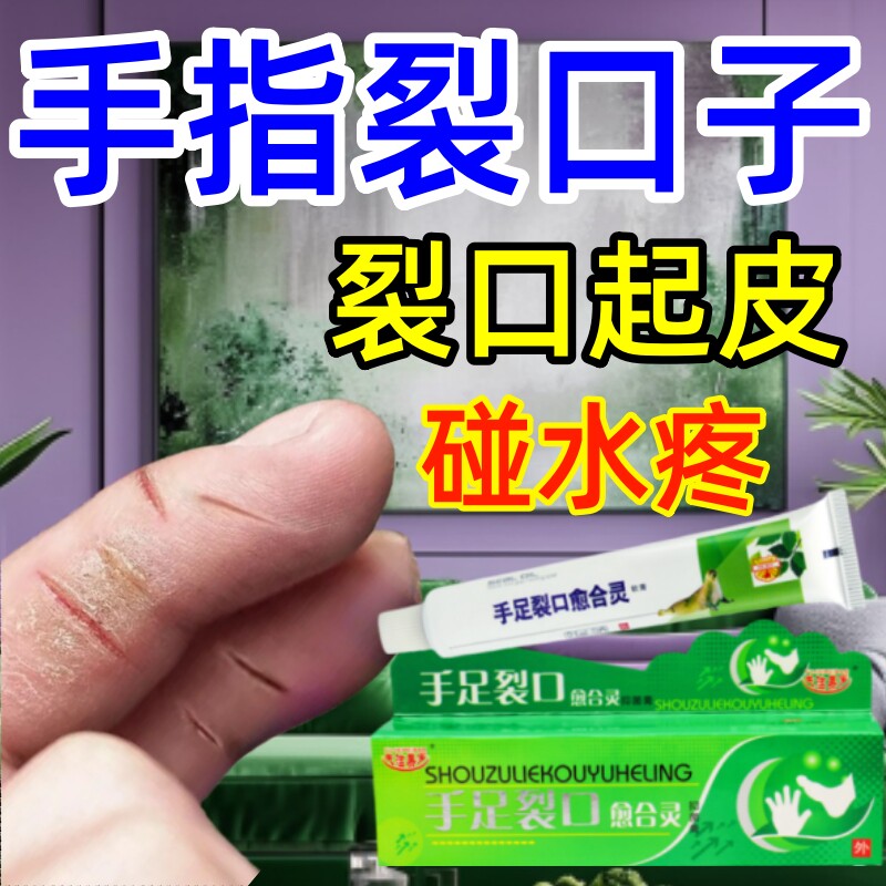 秋冬手裂口药膏手指严重裂口指甲缝裂口脚后干裂防裂开裂愈合修复