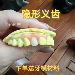牙科同款定制隐形义齿门牙仿真假牙活动假牙老人假牙缺牙少牙镶牙