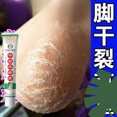 脚后跟干裂起硬皮足跟开裂脚裂手脚脱皮去死皮修复霜