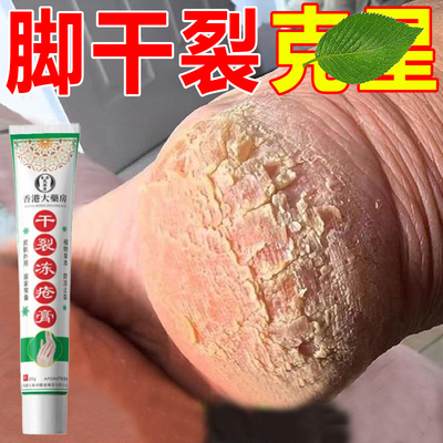 脚后跟干裂起硬皮足跟开裂脚裂手脚脱皮修复霜
