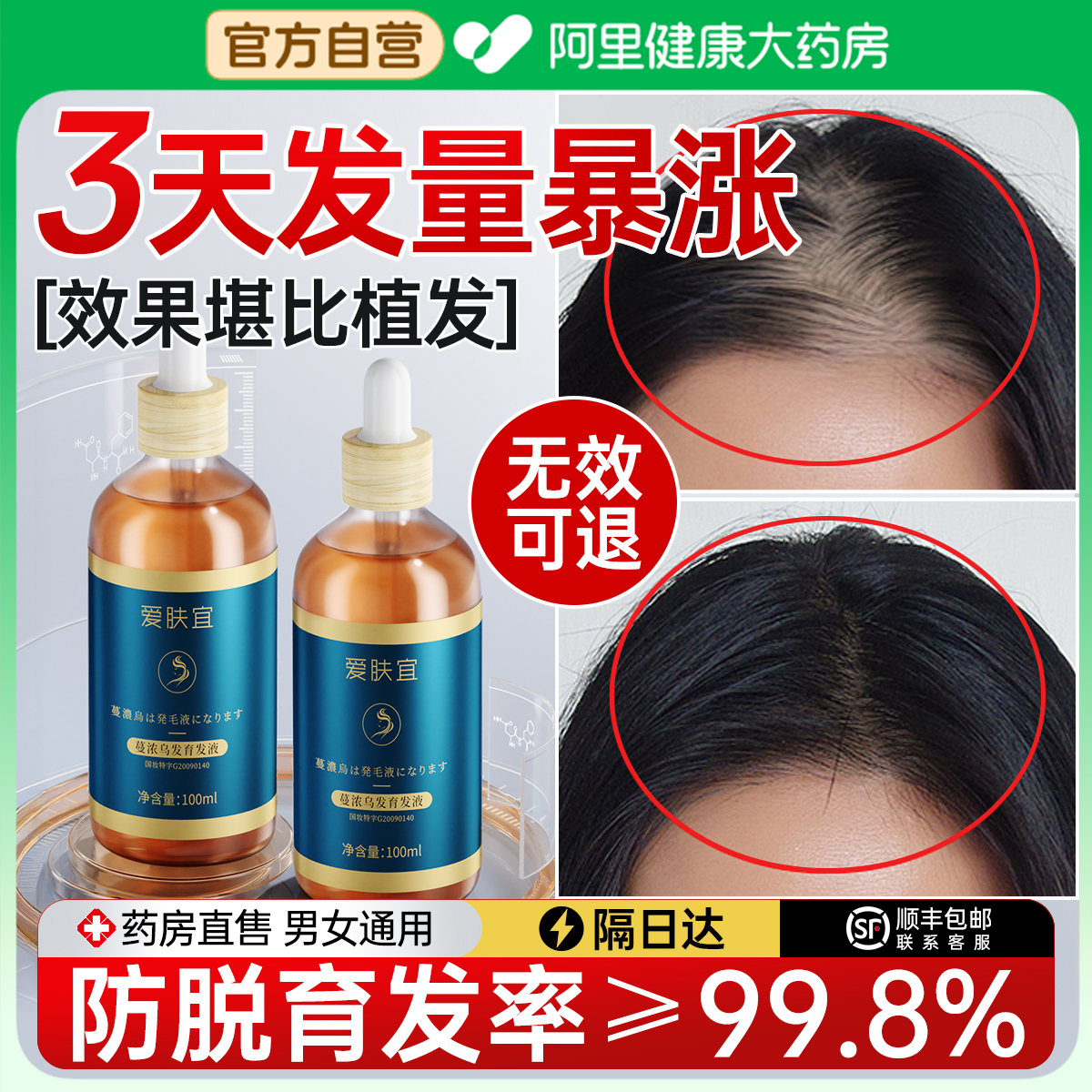 【三甲推荐】强效防脱育发NO.1