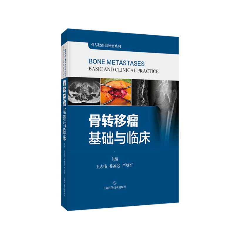 【新华正版】骨转移瘤基础与临床(精)/骨与软组织肿瘤系列 王志伟 上海科技,书籍/杂志/报纸,临床医学,淘宝优惠券,粉丝福利购,淘宝优惠卷