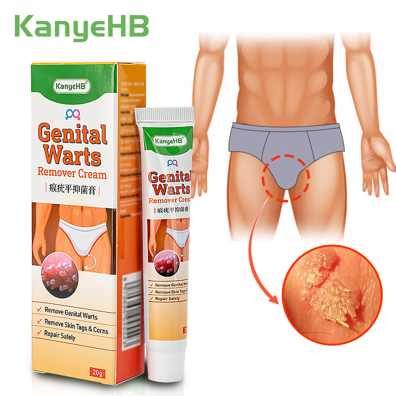 平猴尤祛疣膏 Wart Remover Cream Wish 跨境热销 Ebay Lazada 20