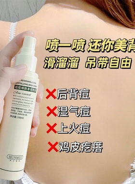 前胸后背祛除痘痘神器祛痘喷雾