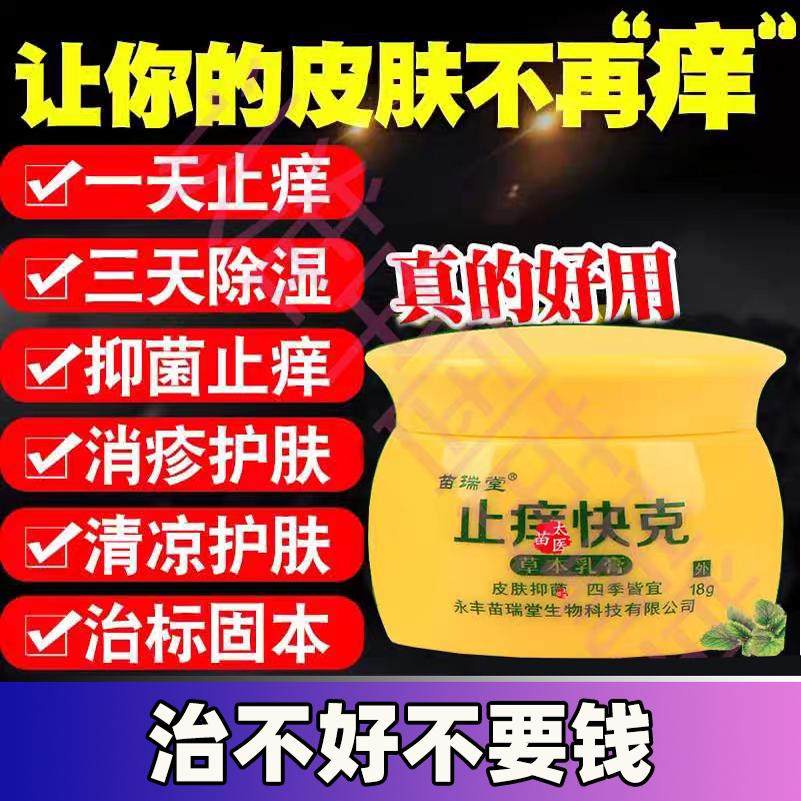 治手脚脱皮乳膏去全身皮肤过敏成人外用私处屁股红痒抑菌止痒软膏