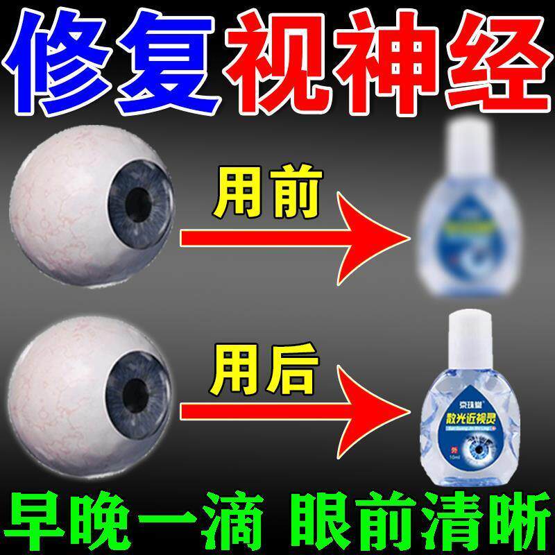 视神经修复专用神器萎靡修复改善洗眼液