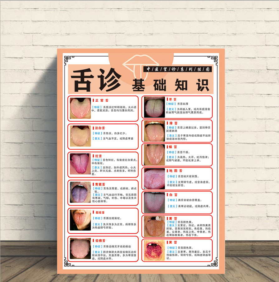 舌诊辩证图解海报中医舌诊健康对照表图中医养生挂图口腔健康贴画