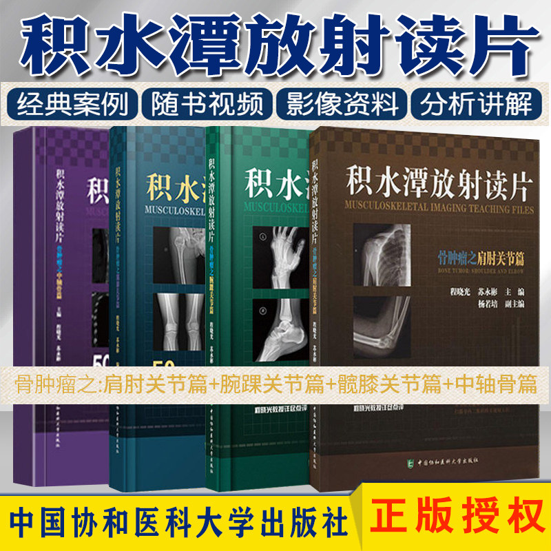 积水潭放射读片 骨肿瘤之腕踝关节篇 积水潭放射读片