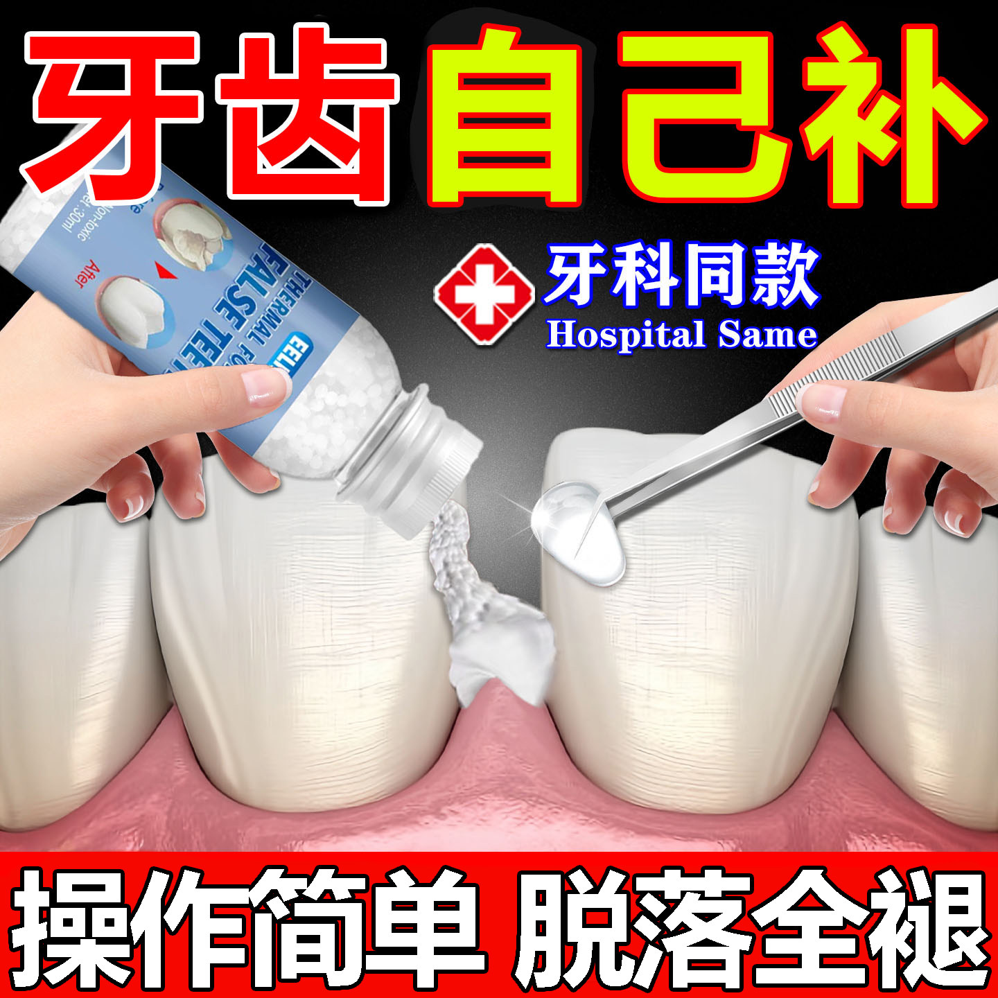 牙齿修补膏牙缝宽自己修补牙齿神器牙洞填充补牙材料树脂修复牙齿