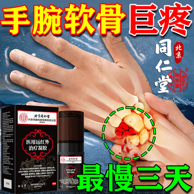 北京同仁堂准用好TFCC手腕疼