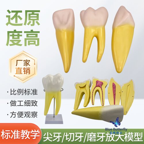 蓝蝶模型磨牙放大解剖部件教具