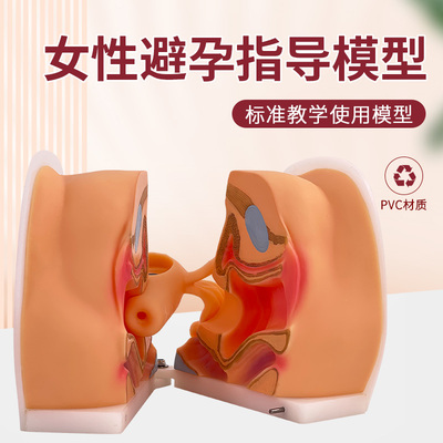 蓝蝶避孕训练妇科生殖解剖模型