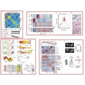 生信分析GEO KEGG差异基因通路富集网络药理PPI WGCNA TCGA GSEA