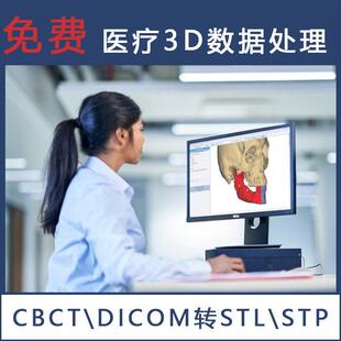 3Ｄ打印医学模型 DCM转STL,STP CT数据三维重建