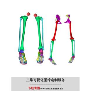 Mimics下肢骨骼医学影像重建DCM影像DCM STL NII文件三维可视化