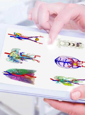 3D打印医学三维可视服务 CT/MRI医疗影像技术服务mimics三维重建