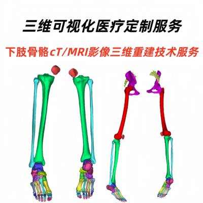 Mimics下肢骨骼医学影像重建DCM影像DCM STL NII文件三维可视化
