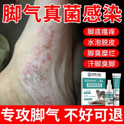 狼毒脚气喷剂雾臭烂丫脱皮