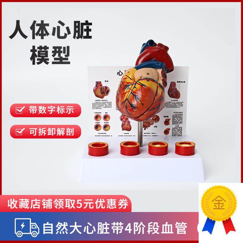 人体心脏模型四阶段血栓可拆卸冠D状动脉心血管血液循环解剖器官