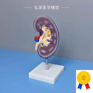 人体肾解剖模型肾脏器官血管内脏结构放大L泌尿系统医学生教学模