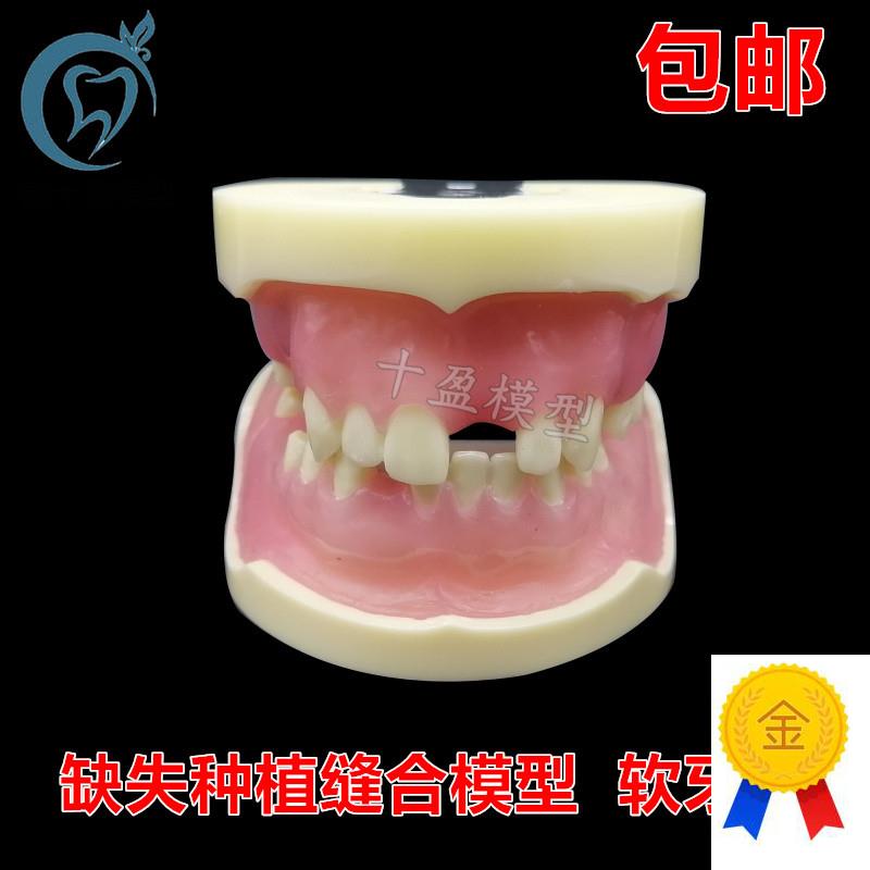 牙科缺失种植模型缝合练习牙模仿骨质牙齿M上颌窦提升术m2002
