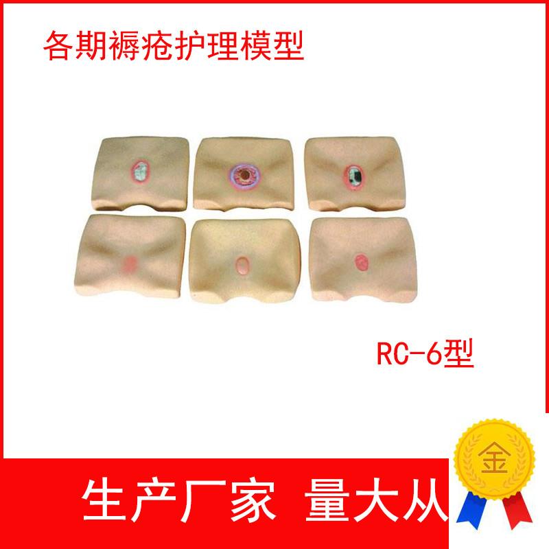 各期褥疮护理模型m四阶段褥疮护理练习模型褥疮护理训练模型
